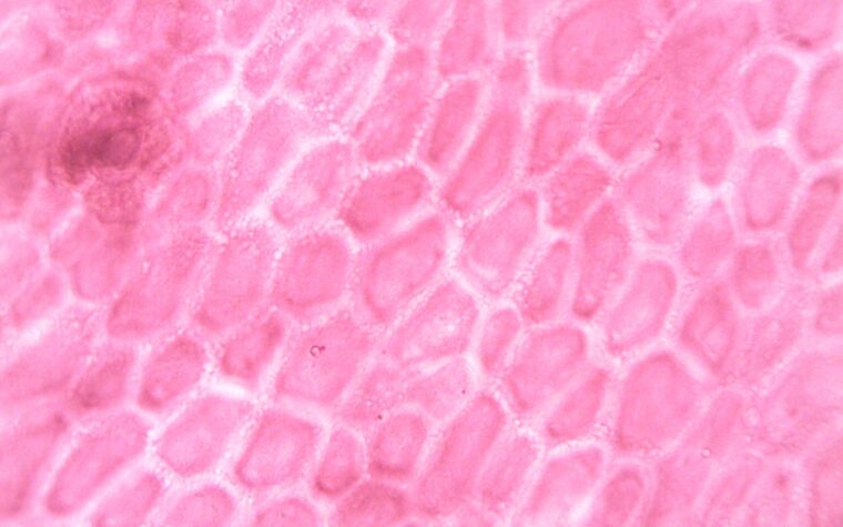 What Is HCT in a Blood Test When It Is High? Causes and What to Do