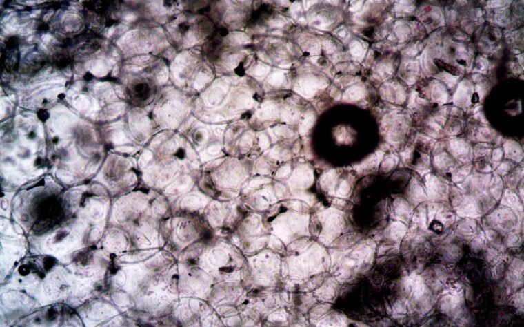 What Is Hematocrit in a Blood Test? The Number Dehydration Can Quietly Fake
