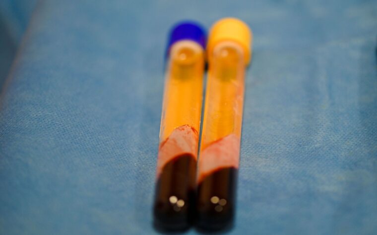 What Is MPV in a Blood Test? The Platelet Size Clue Most People Scroll Past