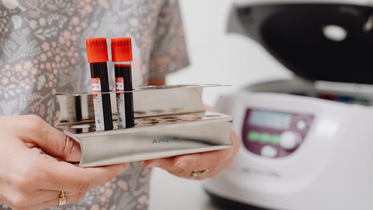 What Is NRBC in a Blood Test? The CBC Number That Should Read Zero