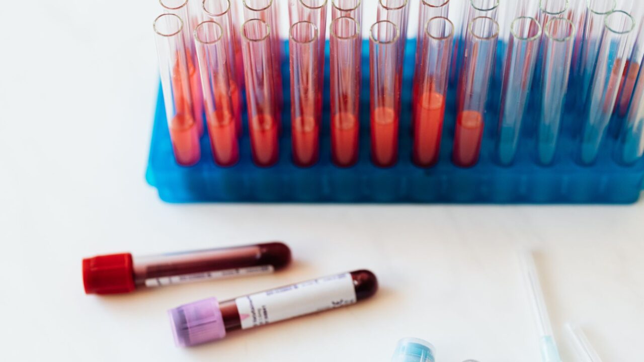 What Is PLT in a Blood Test? The Platelet Number That Decides How You Bleed and Clot