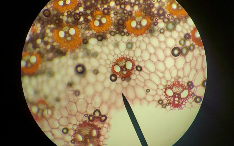 What Is RDW in a Blood Test? The Underrated Number That Predicts More Than Anemia