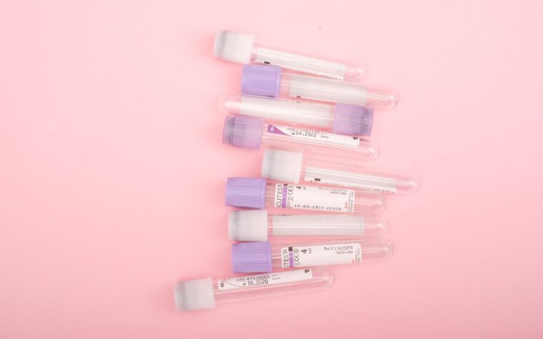 GC-MS Urine Analysis Shows Promise for Detecting Bladder Cancer