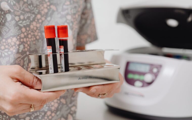 FDA Clears Roche Elecsys pTau217 Blood Test for Alzheimer Disease