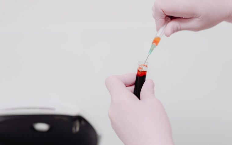 Comparing Epigenetic Aging Biomarkers: Which Clocks Respond Most to Lifestyle Changes?