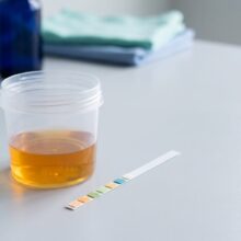 Ketones in Urine: What Trace, Small, Moderate, and Large Mean