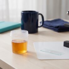 Leukocytes in Urine: What Trace to Large Results Mean