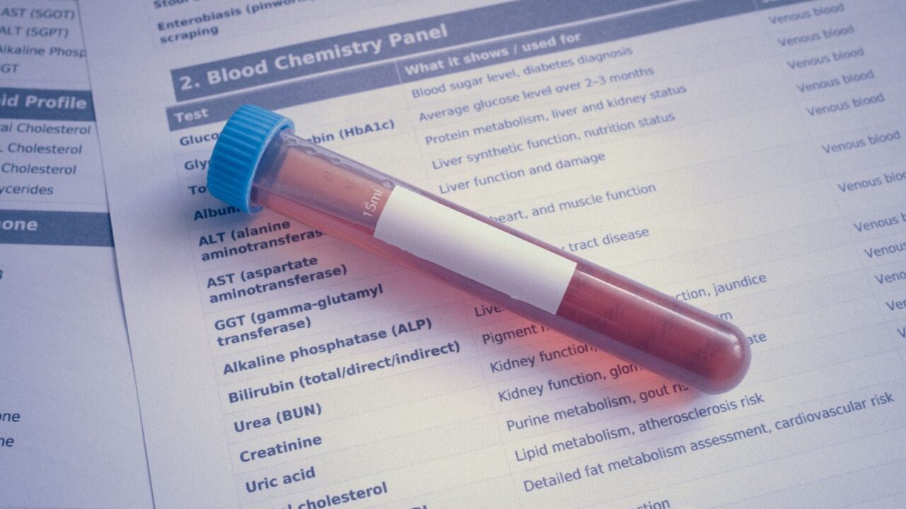Third-Party Testing for Supplements: How to Verify What’s Actually in the Bottle