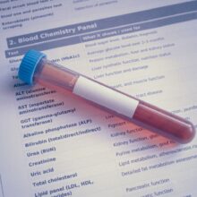 Third-Party Testing for Supplements: How to Verify What’s Actually in the Bottle