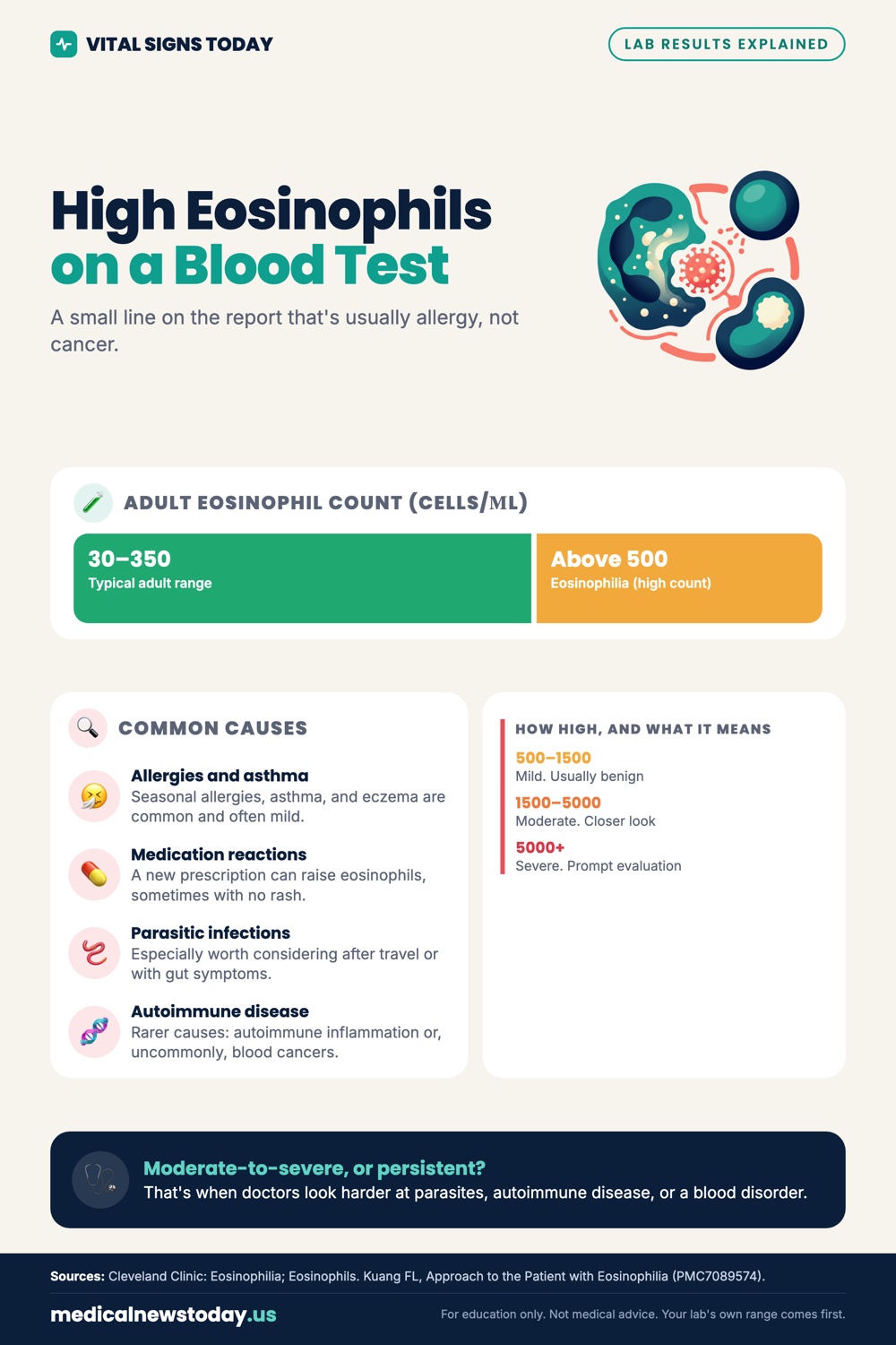 High Eosinophils on a Blood Test infographic: A small line on the report that's usually allergy, not cancer.
