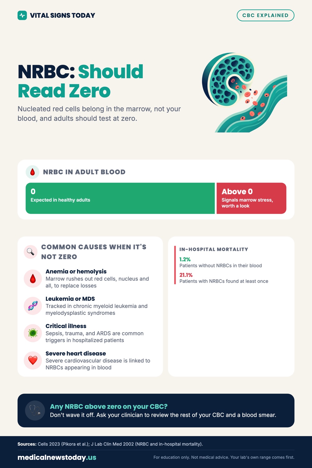 NRBC: Should Read Zero infographic: Nucleated red cells belong in the marrow, not your blood, and adults should test at zero.