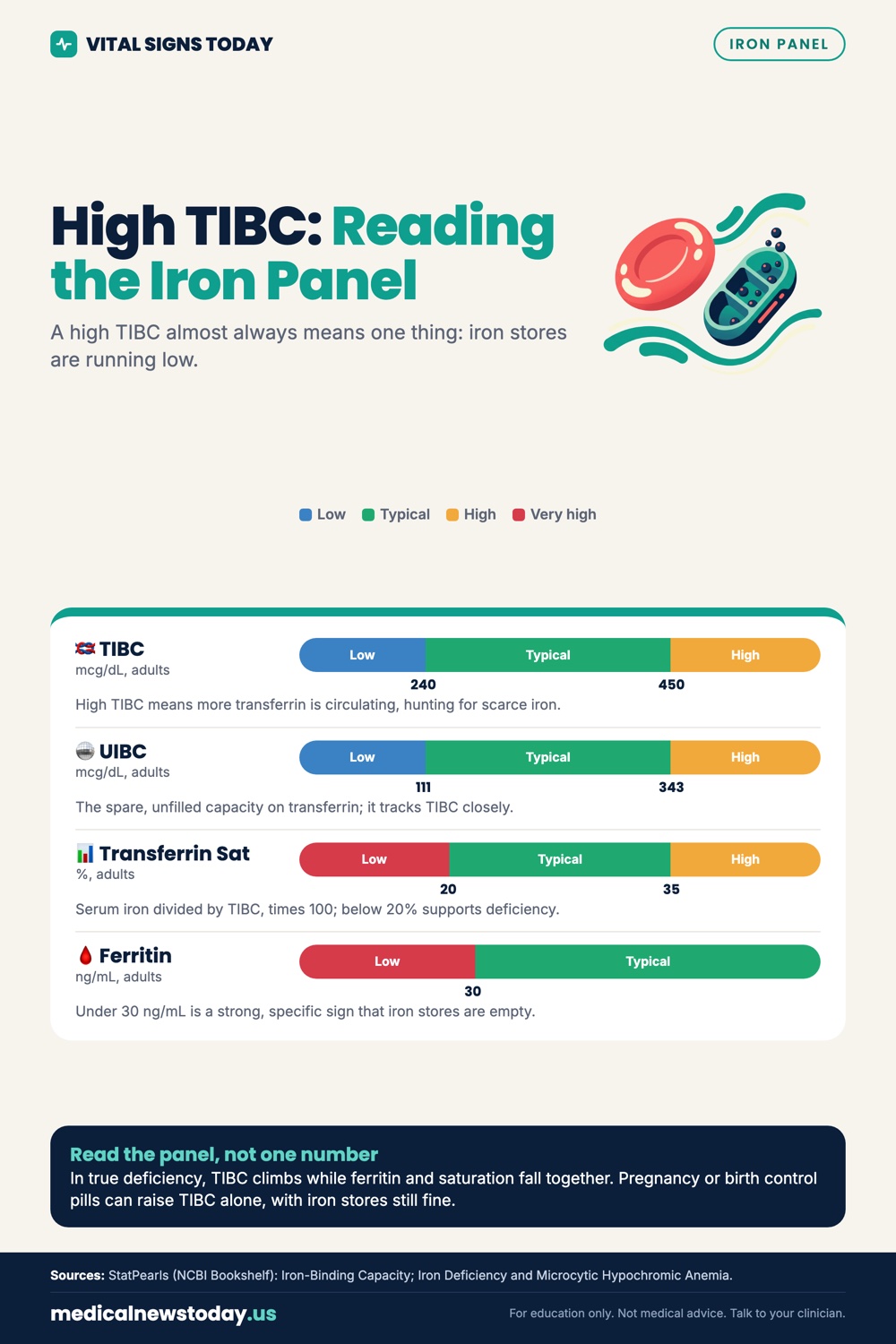 High TIBC: Reading the Iron Panel infographic: A high TIBC almost always means one thing: iron stores are running low.